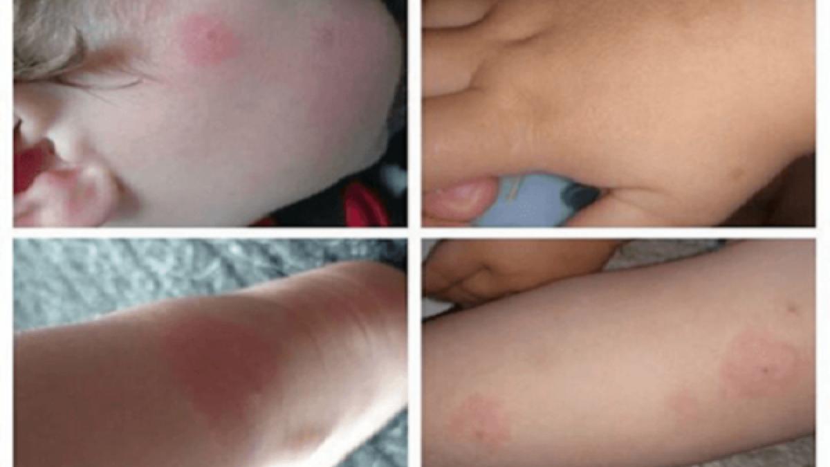 a descoperit aceste semne ciudate pe corpul fiului sau informatia aceasta iti poate salva copilul