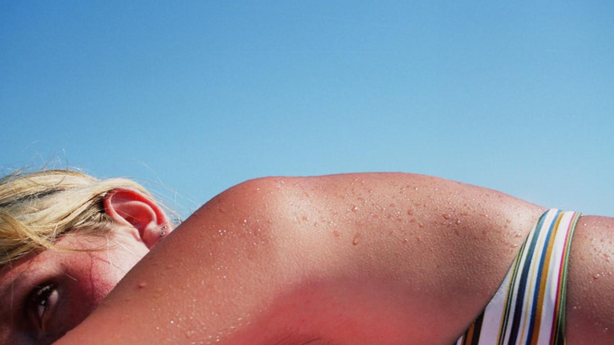 ultraviolete radiatii soare plaja crema protectie solara