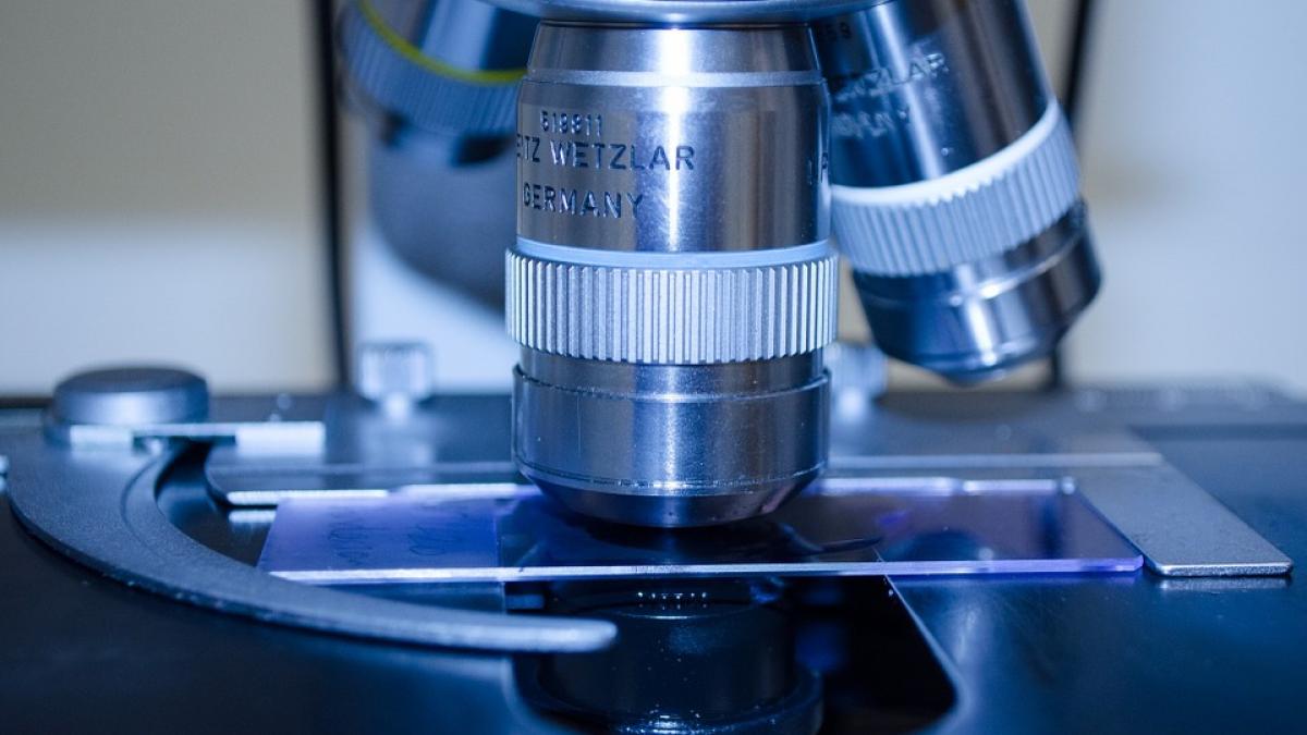 succes fara precedent a fost identificata originea virusului hiv