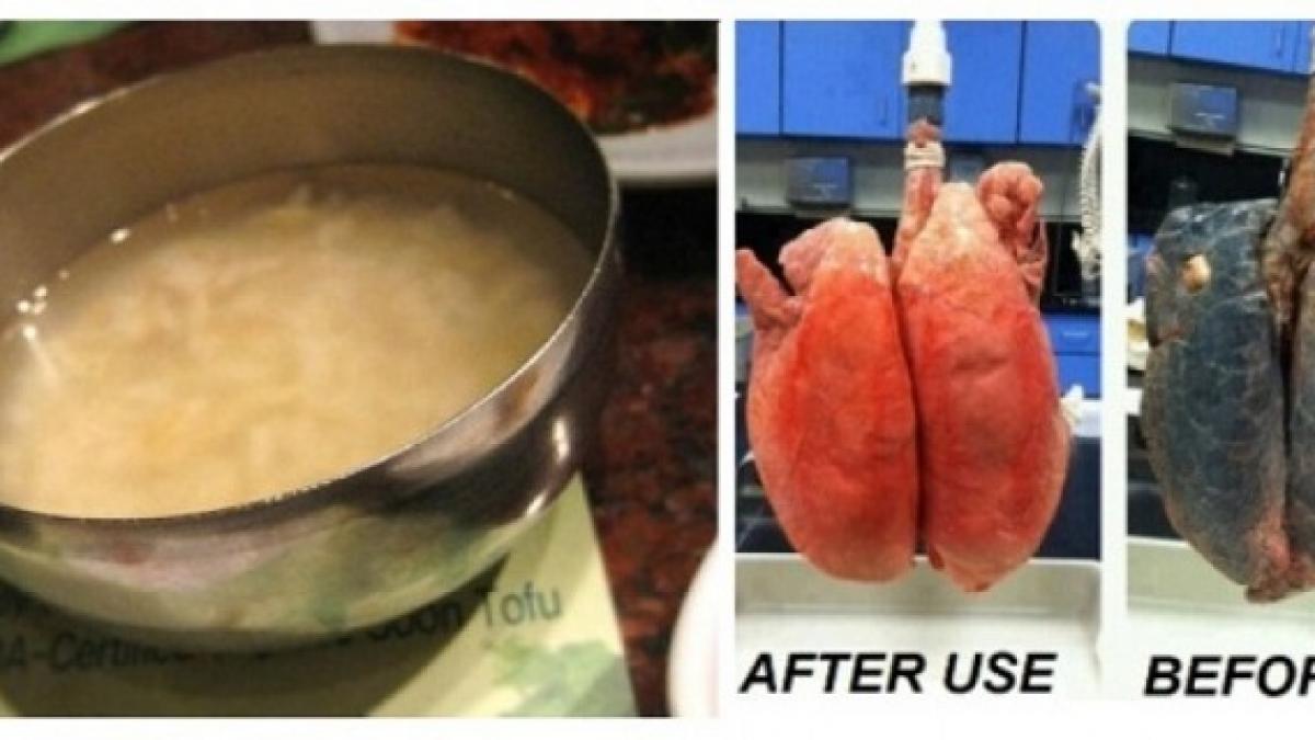 fumezi de ani de zile reteta asta iti curata plamanii in doar trei zile