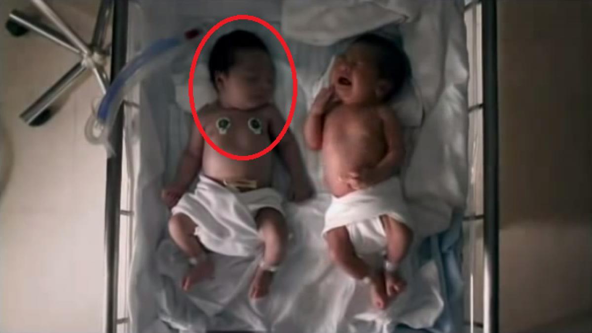 doctorii i au spus ca pentru unul dintre gemeni nu se mai poate face nimic gestul rascolitor facut