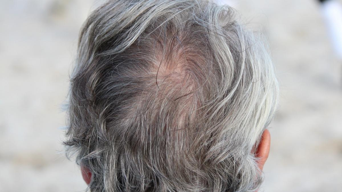 socant acesta este adevaratul motiv pentru care iti albeste parul sigur nu stiai asta