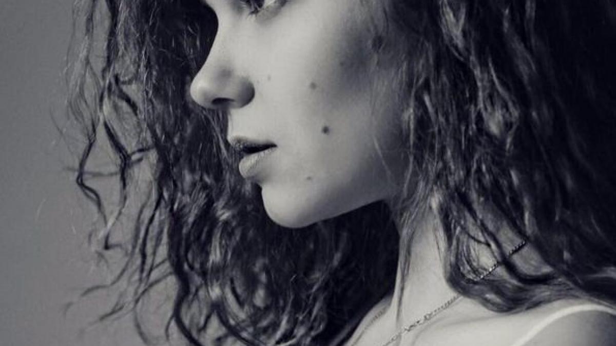 colegii de scoala o porecleau girafa din cauza alunitelor care i au acoperit corpul cum arata acum