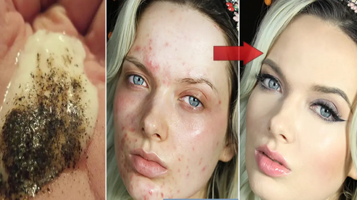 amesteca aceste doua ingrediente si vezi ce se intampla cu pielea ta cateva minute mai tarziu