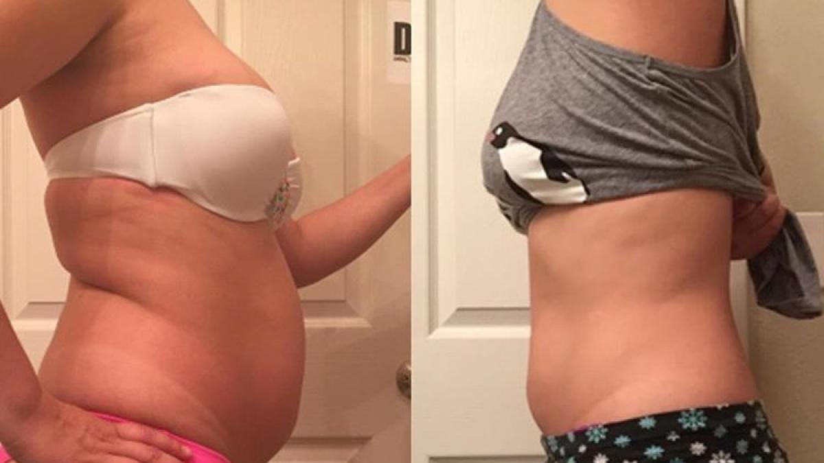 vrei sa slabesti iata ce trebuie sa faci imediat dupa ce te trezesti