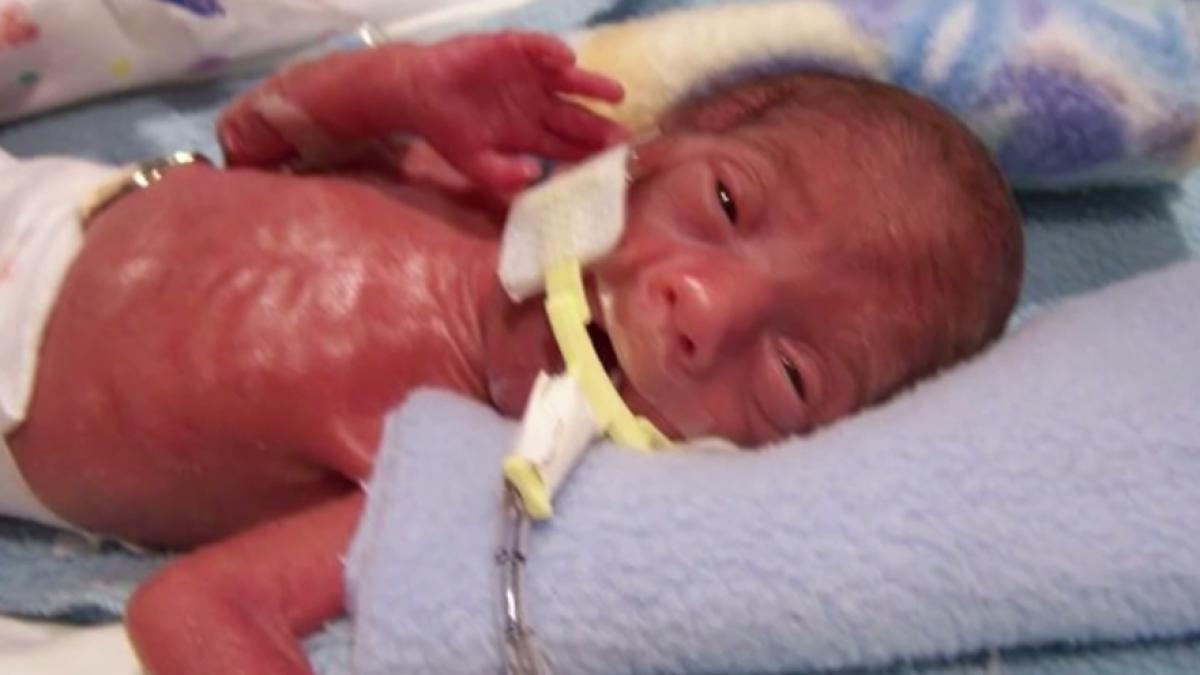 a facut o poza bebelusului imediat ce a deschis ochii cativa ani mai tarziu s a intamplat ceva