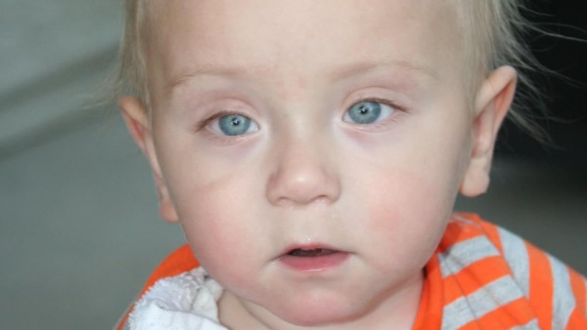 medicii le au spus parintilor ca baietelul lor are doar o raceala au urmat 65 de operatii din cauza