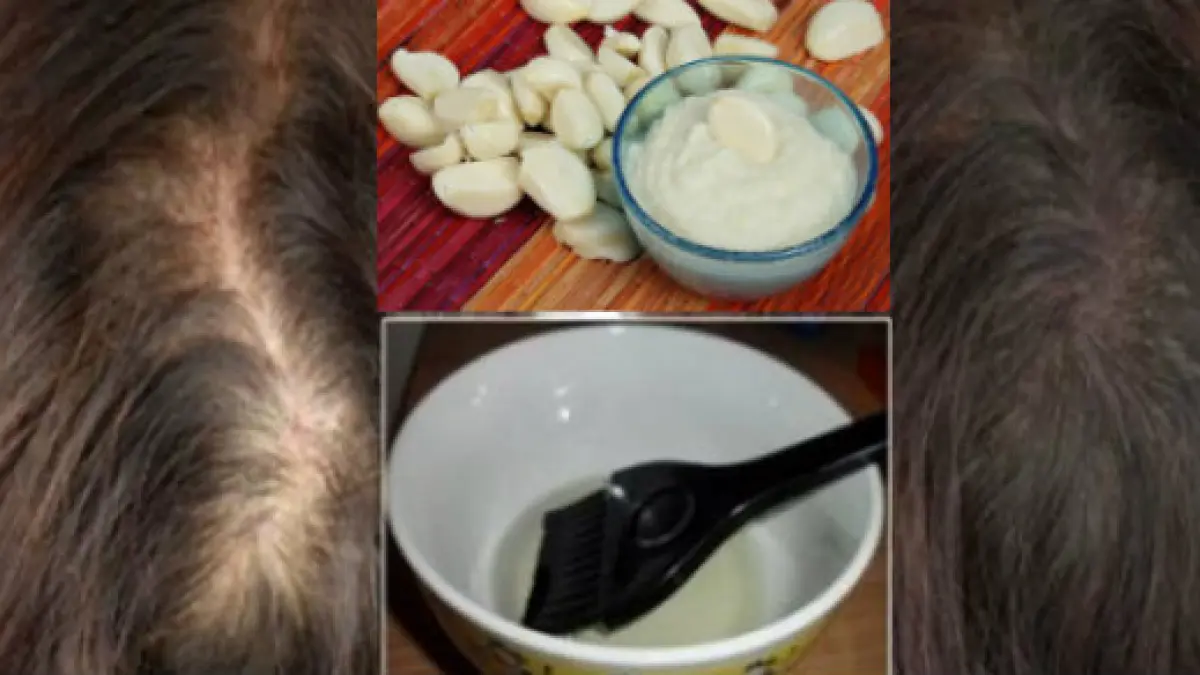 si a pus usturoi si ulei de ricin pe par cand s a uitat in oglinda a ramas uimita efectele apar