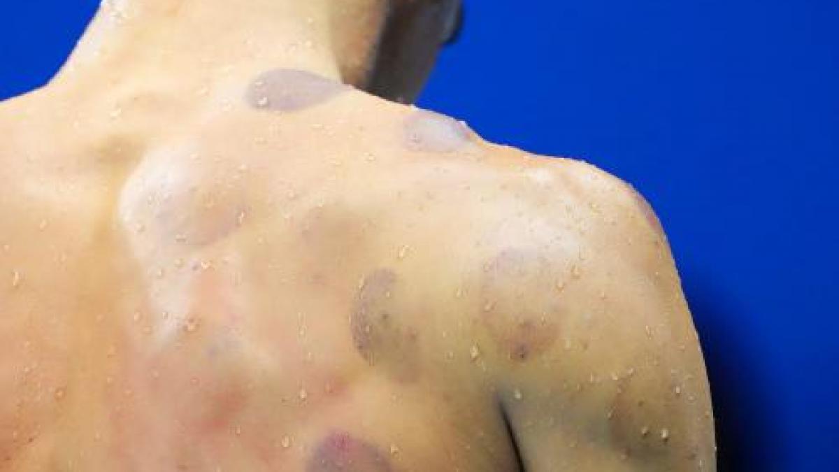 olimpiada de ce au aparut sportivi plini de vanatai la rio explicatia este una foarte simpla