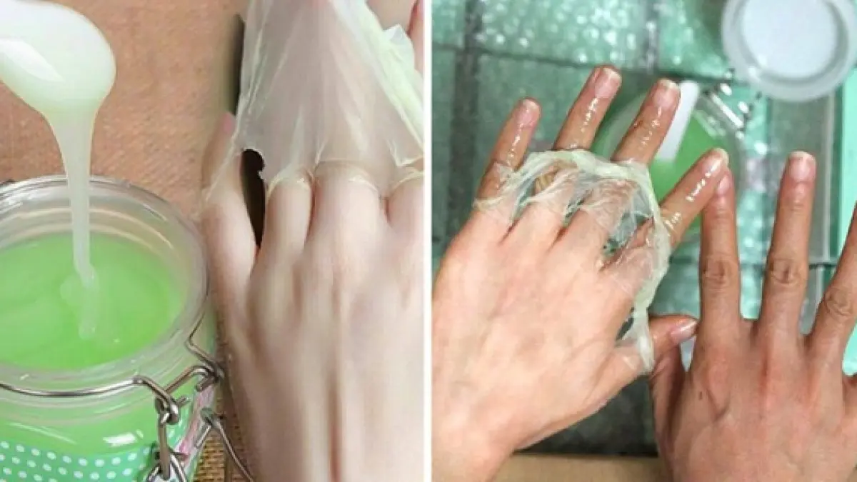 avea pete inchise la culoare pe maini toata lumea a intrebat o cum a scapat de ele dupa ce a aparut