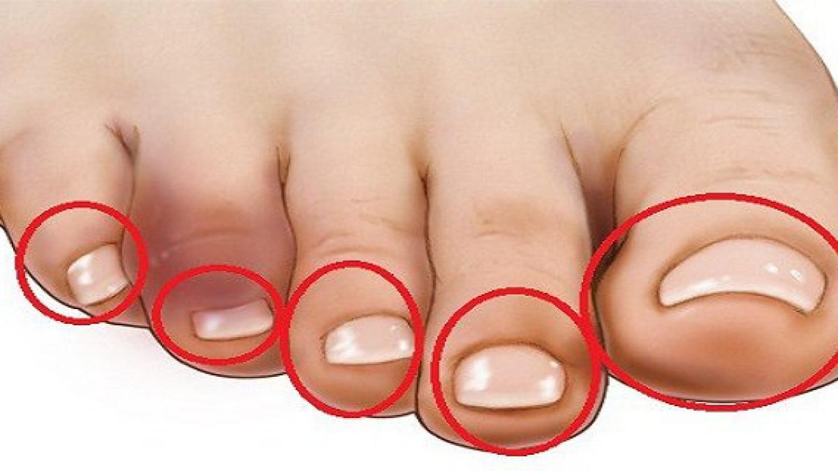 foarte tare atinge ti degetele de la picioare si afla daca ai probleme cu inima