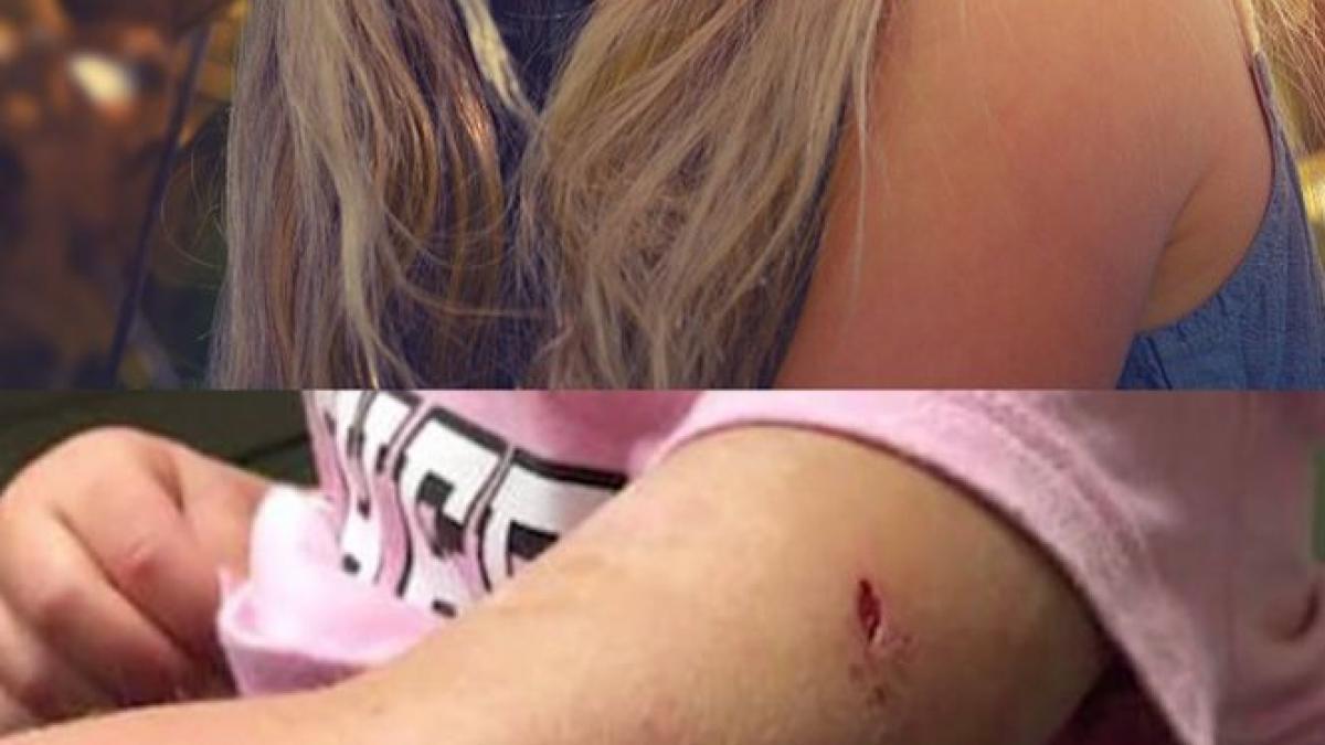 se aflau in padure alaturi de fetita lor copila a fost atacata de un animal salbatic a tarat o