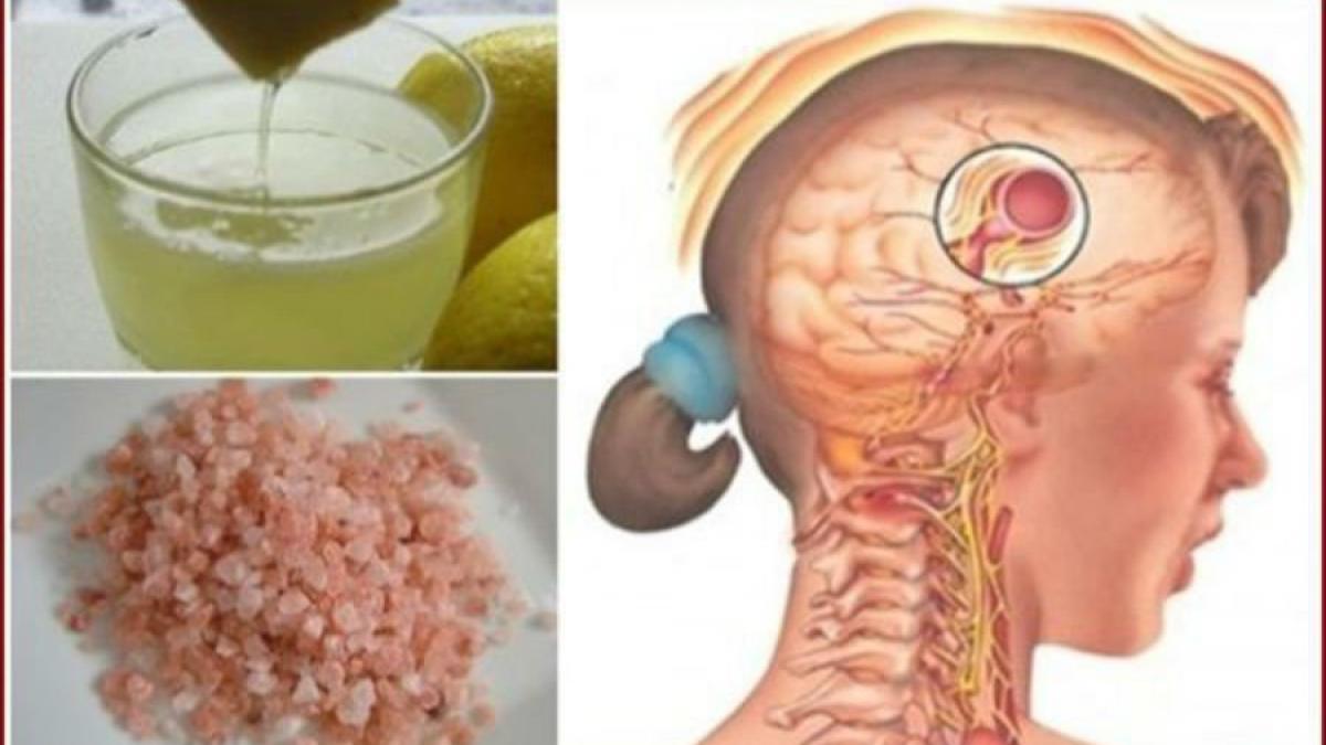 migrenele dispar in 10 minute cu aceasta bautura delicioasa