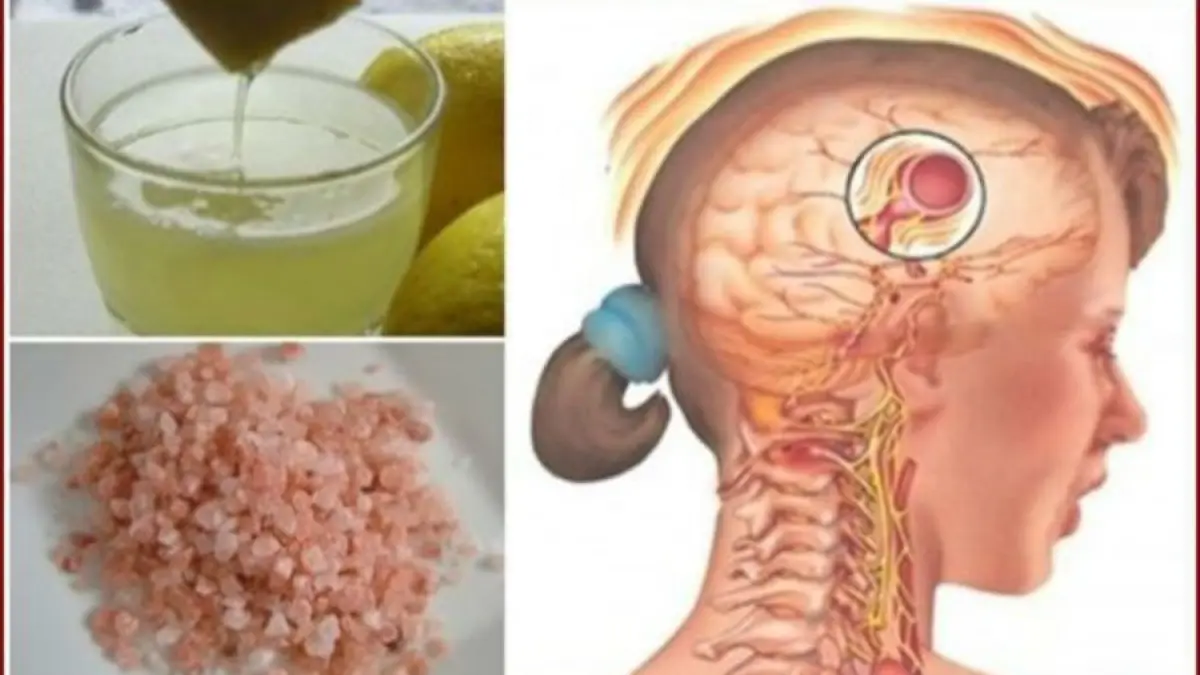 migrenele dispar in 10 minute cu aceasta bautura delicioasa