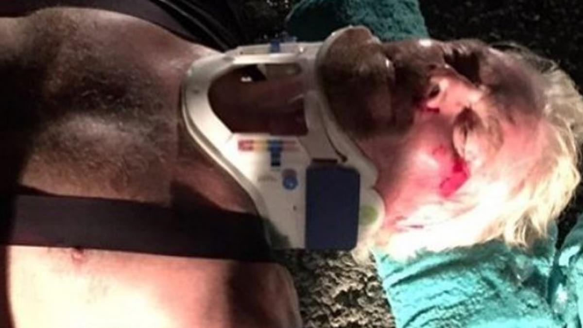 richard branson a suferit un grav accident cu bicicleta