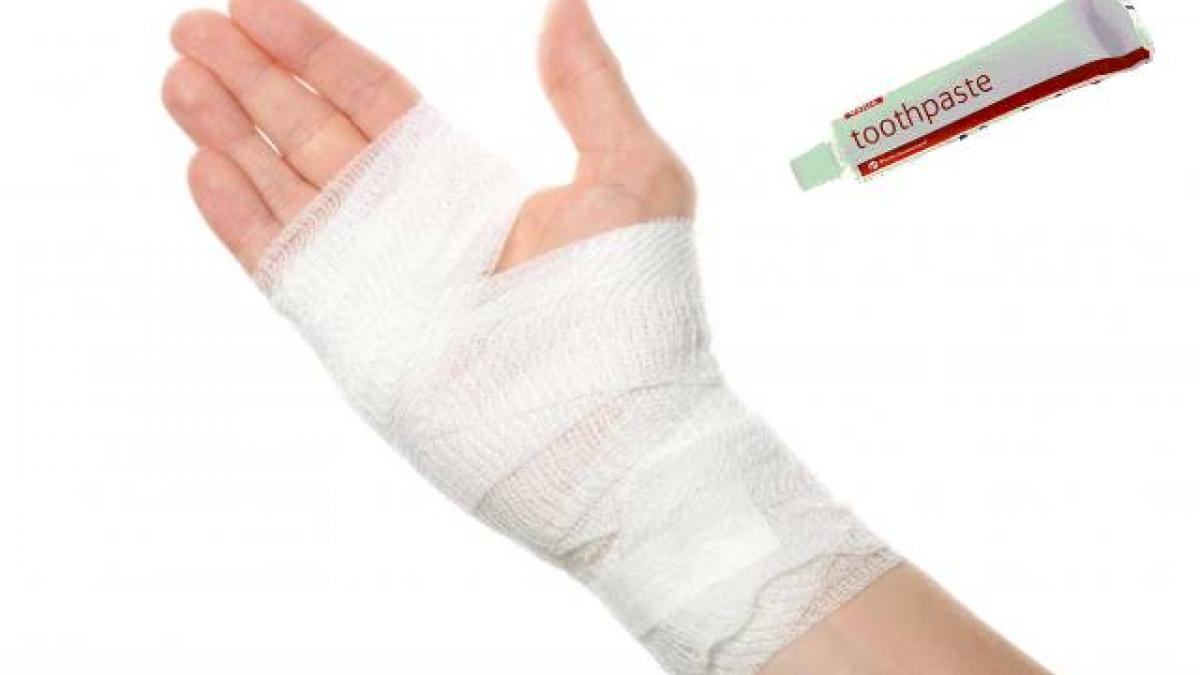 si a aplicat pasta de dinti pe mana apoi a acoperit cu tifon motivul este uimitor