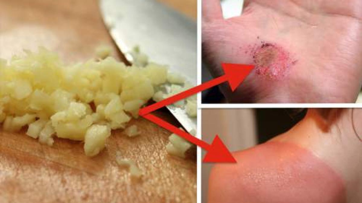 acest ingredient natural face minuni pentru pielea ta uite cum sa l folosesti