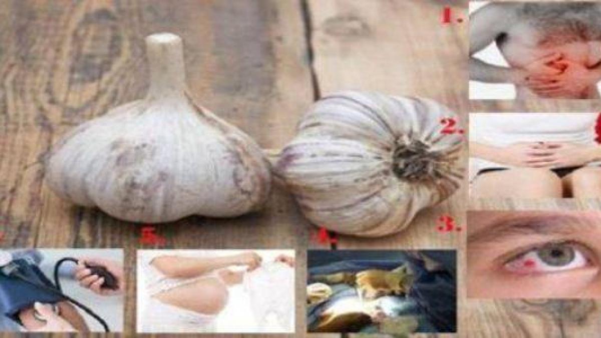 ai aceste boli nu mai consuma deloc usturoi este foarte periculos