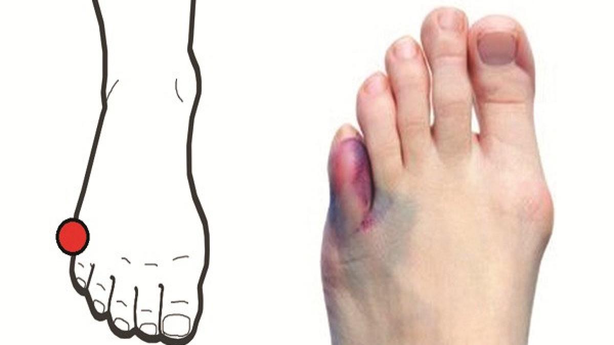 adevarul despre durerea uriasa pe care o simti cand te lovesti la cot sau la degetul mic de la