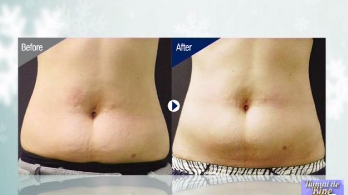 numai de bine tehnologia care topeste grasimea