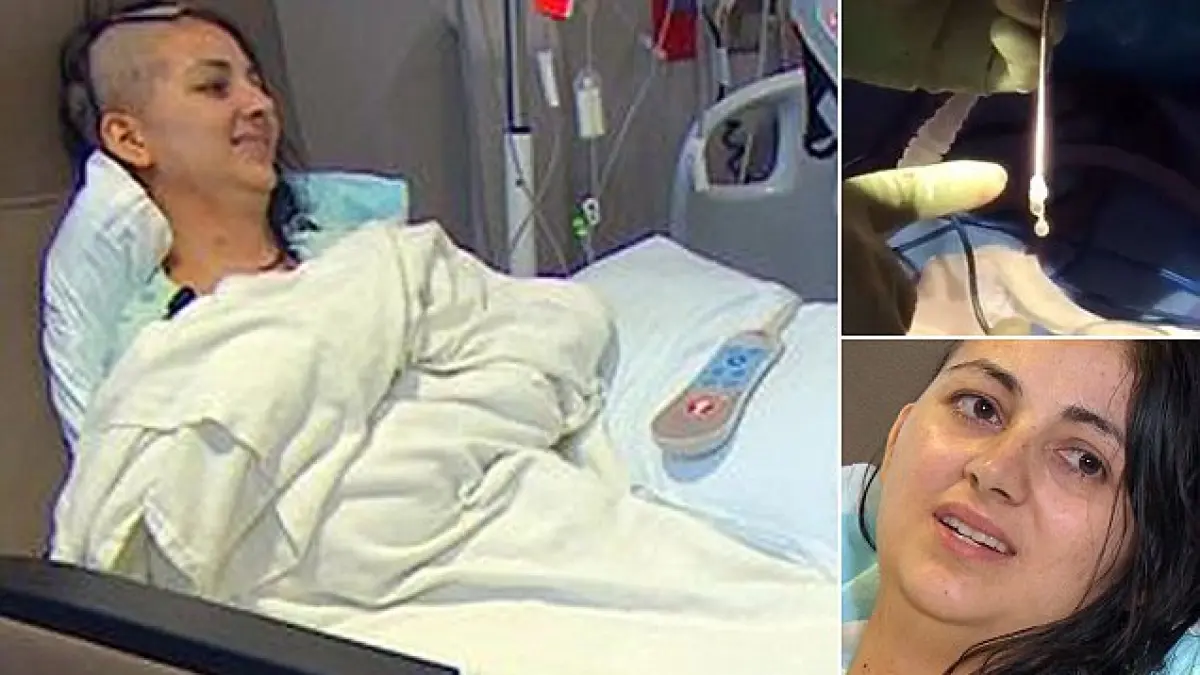femeia asta a avut dureri ingrozitoare de cap timp de 9 luni apoi doctorii i au scos asta din cap
