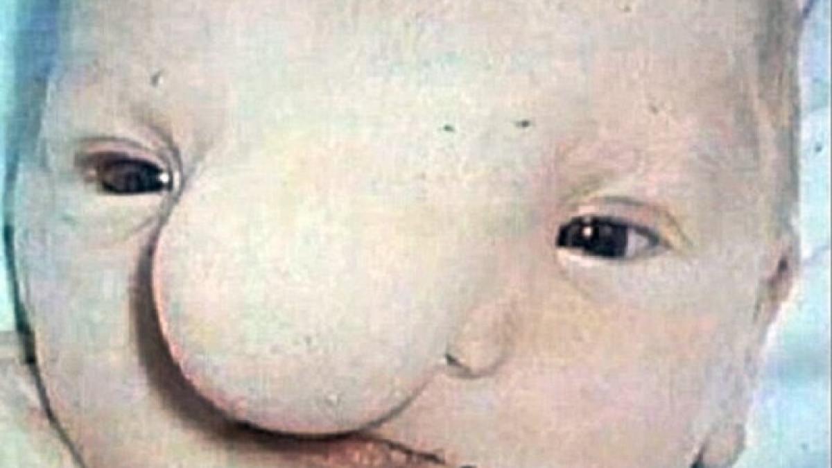 si a dorit ca fiul ei sa moara imediat dupa ce l a nascut avea o tumora imensa pe fata