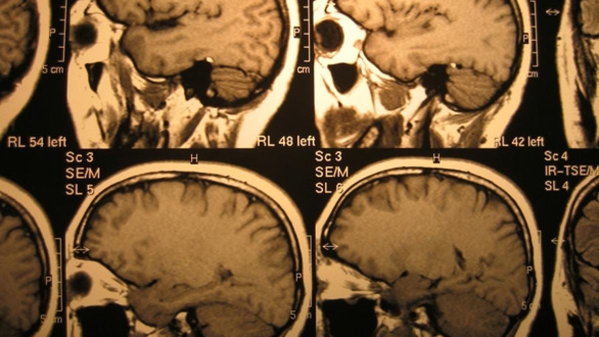 se plangea ca nu o mai incap hainele si pantofii si a mers la spital diagnosticul pus de medici a