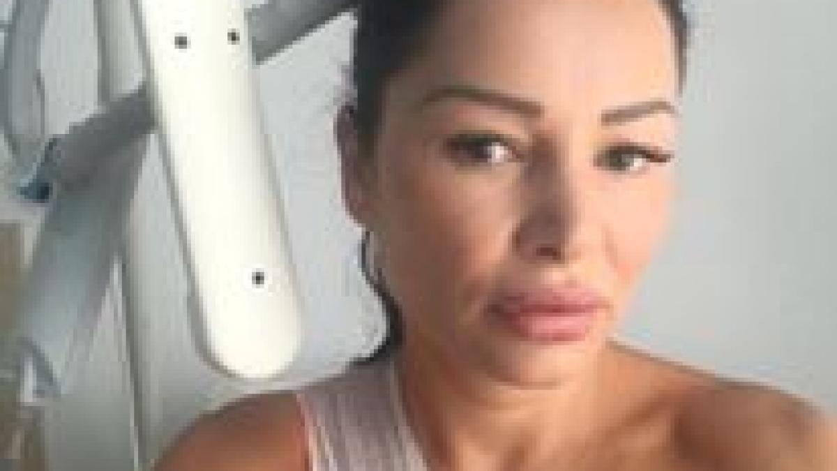 un cosmar fara sfarsit brigitte sfat voi avea o cicatrice toata viata