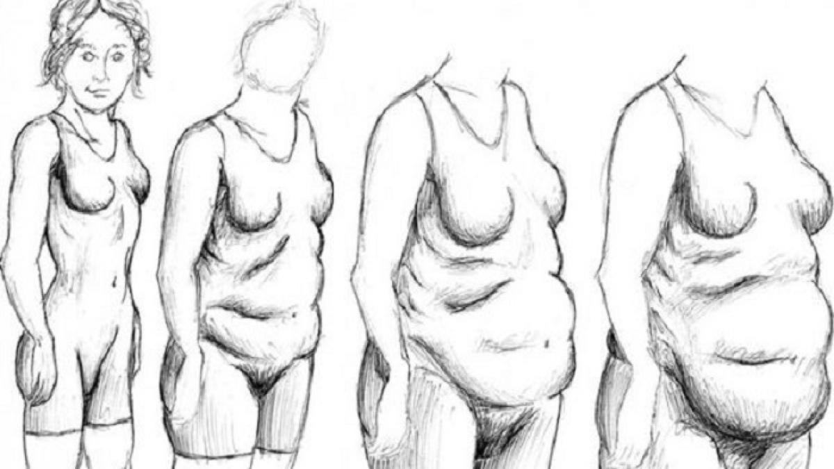 nu poti sa slabesti hormonul asta e de vina uite cum poti sa rezolvi problema si sa scapi de