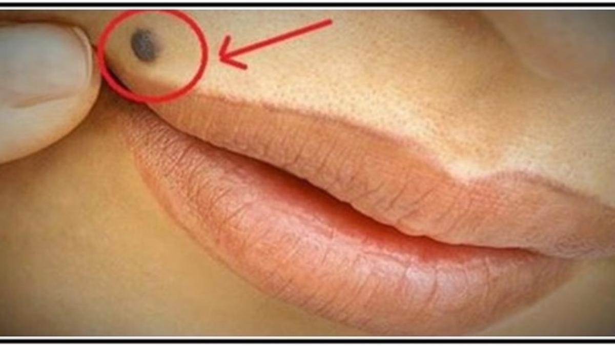 si tu ai aceasta alunita in coltul gurii uite ce spune asta despre tine