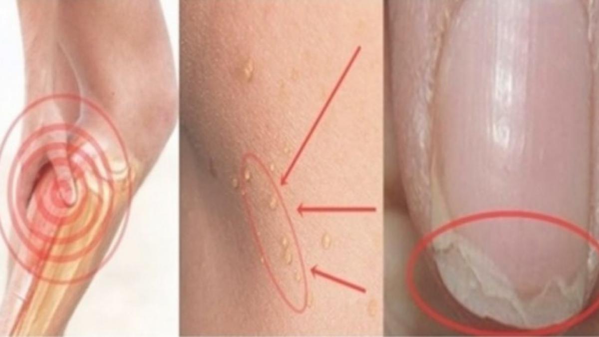 te doare capul des ai cosuri si probleme cu unghiile trebuie sa citesti urgent asta