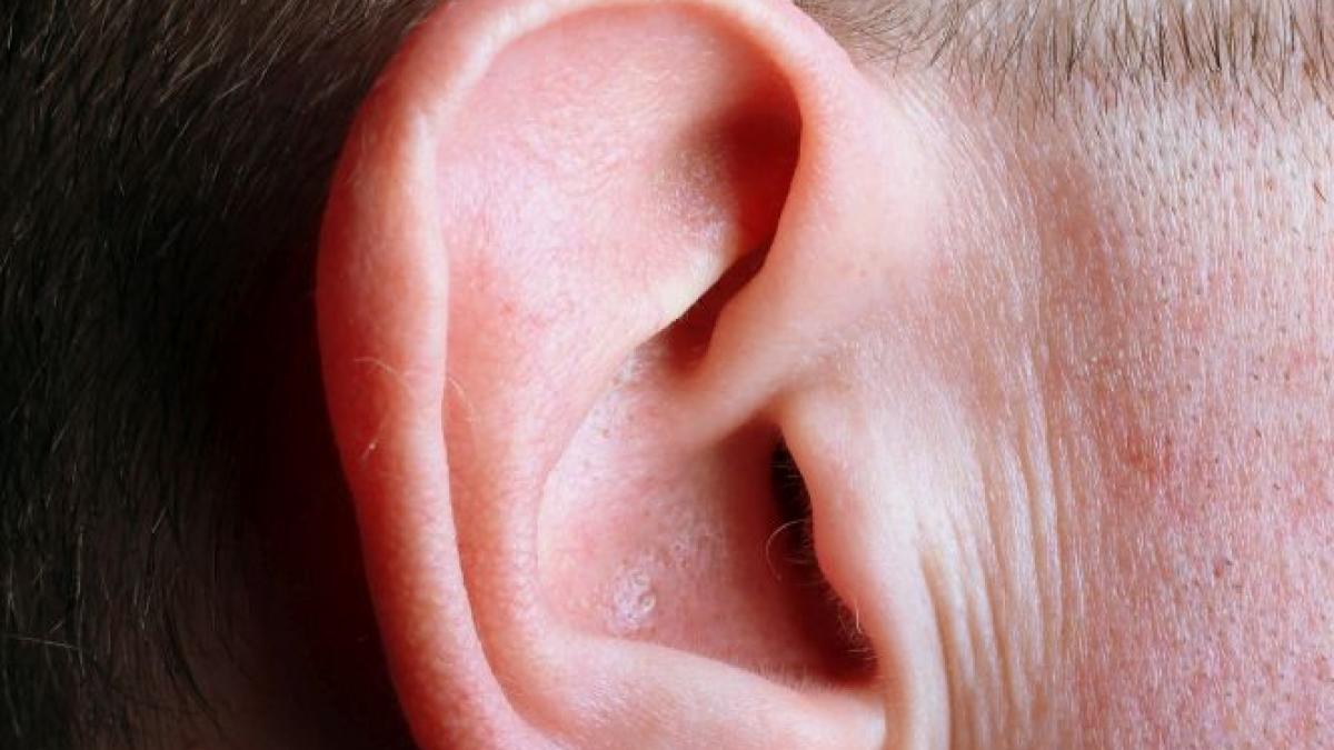 a simtit ca il gadila ceva la ureche cateva minute mai tarziu era paralizat ce a patit barbatul