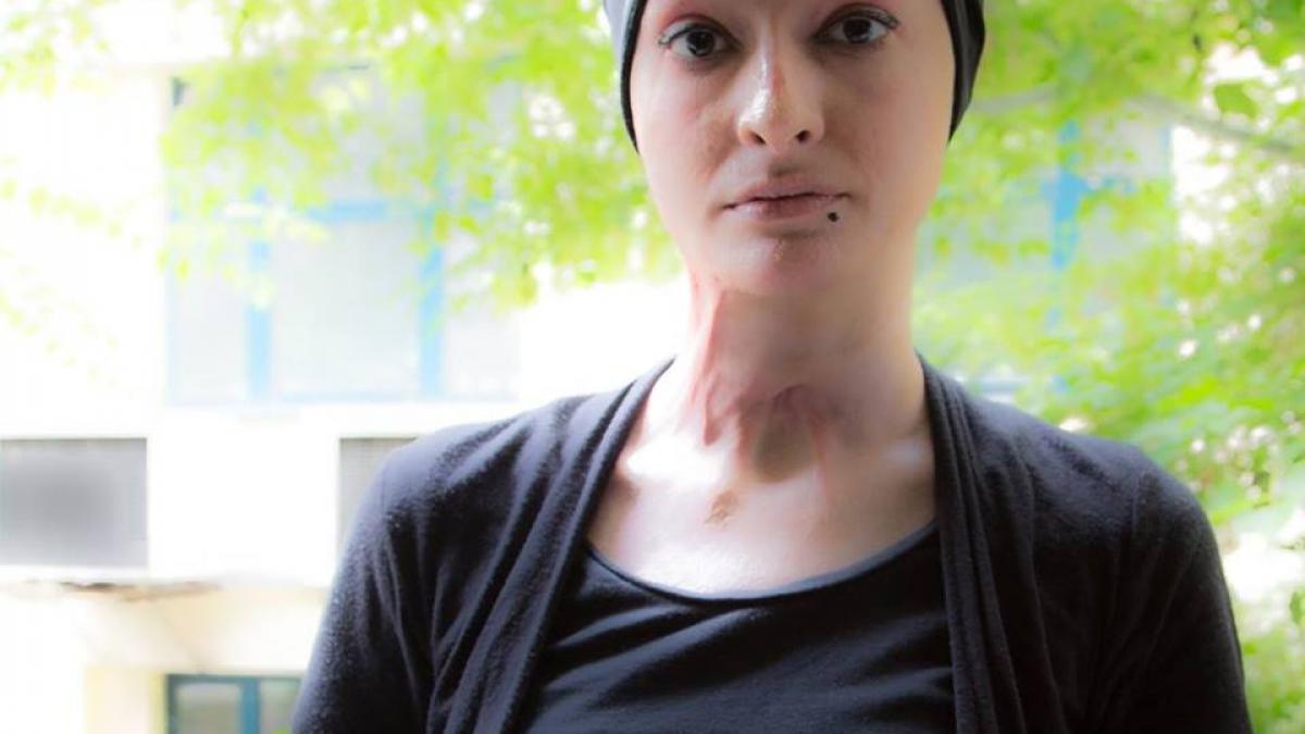 drama unei supravietuitoare din colectiv m am jucat cu o mana bionica