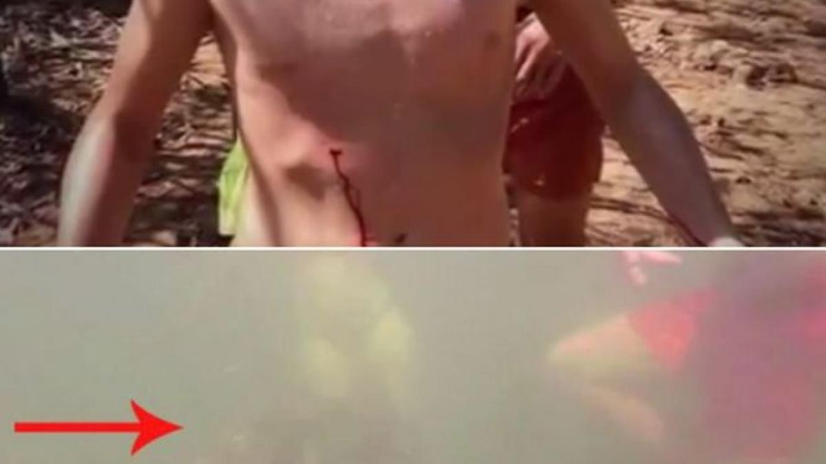 inota linistit alaturi de familia lui a simti ca sangereaza puternic si a intrat in stare de soc ce