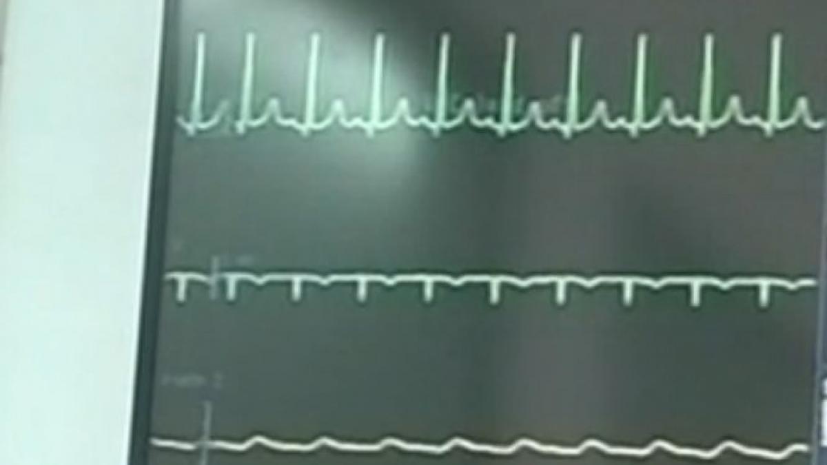 un politist din capitala in stare critica la spital i s a oprit inima