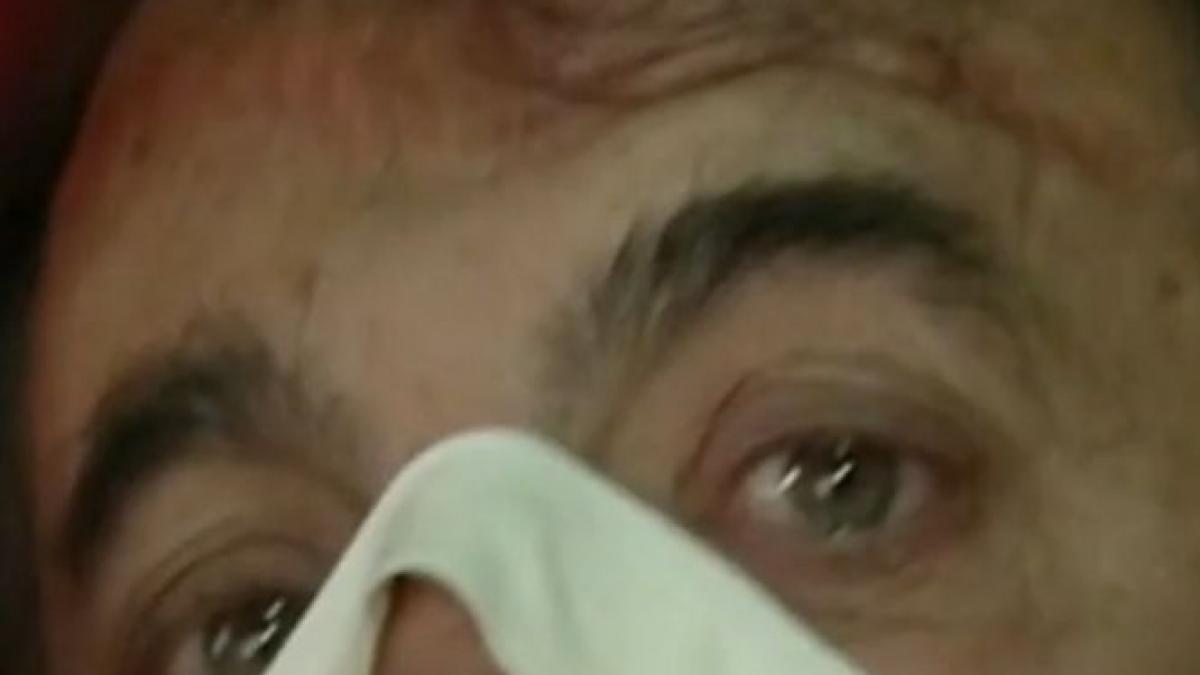 il durea maseaua si doctorii i au taiat nasul