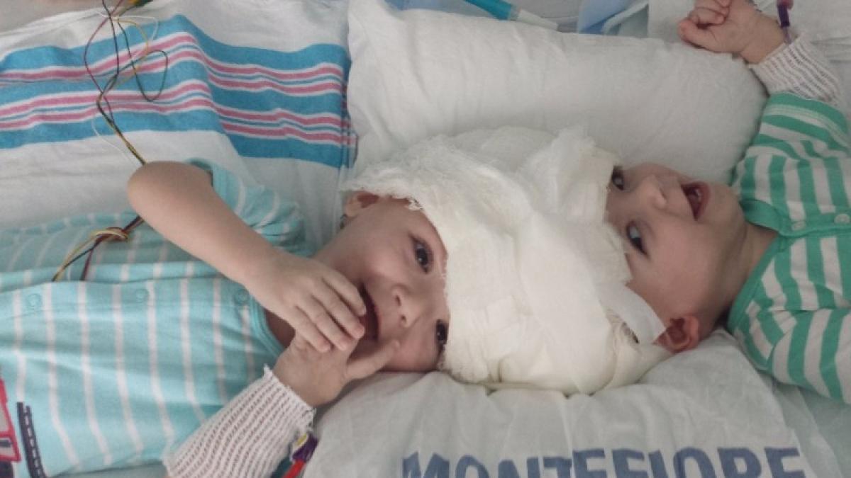 s au nascut lipiti in zona capului dar vor duce o viata normala nimeni nu le dadea sanse de