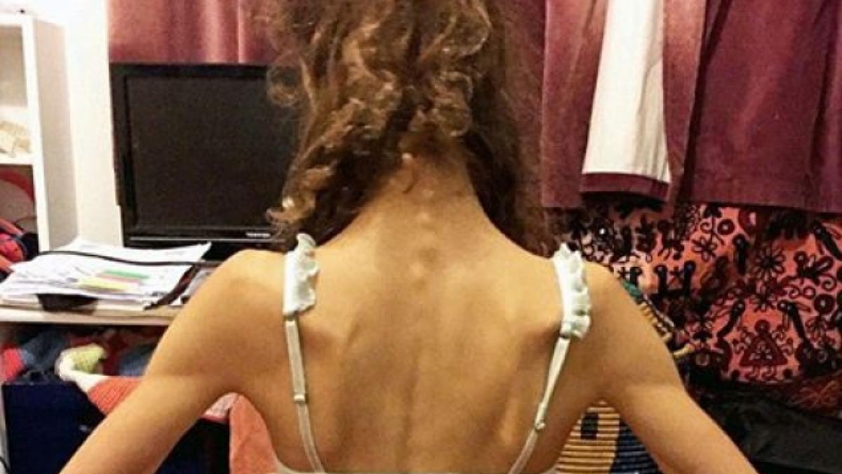 a ajuns la un pas de moarte din cauza comentariilor rautacioase tanara a ajuns sa cantareasca 25 de