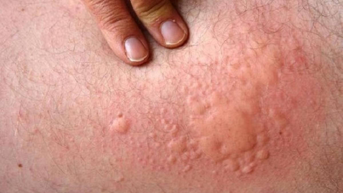 a mancat asa ceva si s a umplut de bube si tu il consumi zilnic