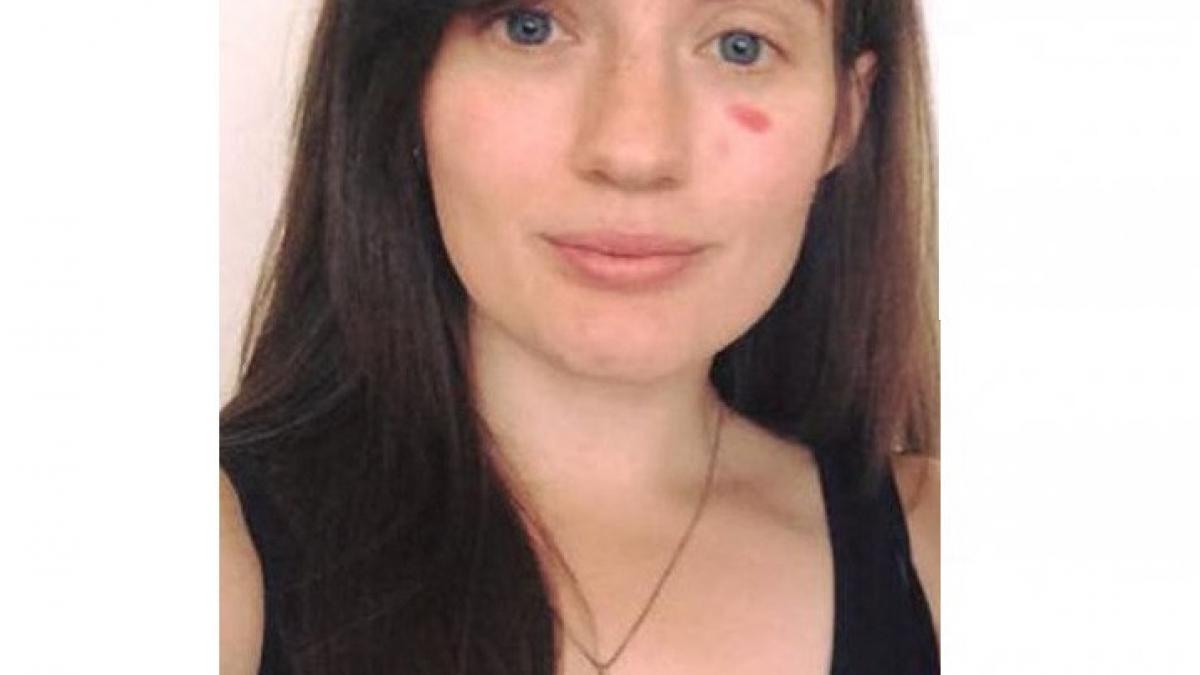 isi deseneaza cu rujul o pata sub ochi in fiecare zi adevarul din spatele acestui gest te va uimi