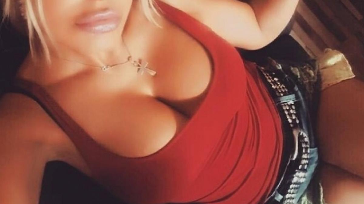 o vedeta de la noi s a desfigurat si a pus de sase ori mai mult acid hialuronic decat a trebuit si