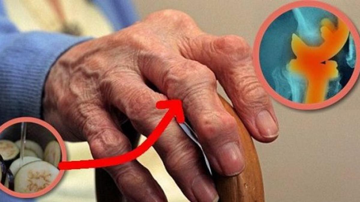 avea dureri ingrozitoare asa ca a amestecat ingredientele astea si a folosit o reteta uimitoare