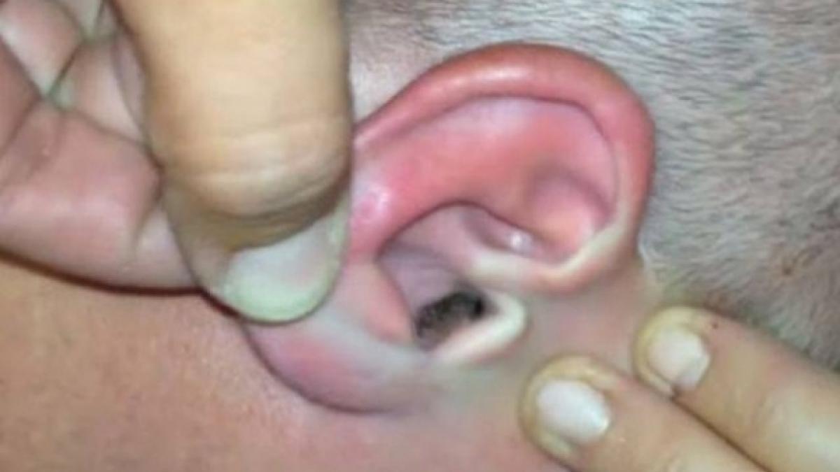 il manca urechea pe interior de cateva luni si nu stia de ce la control doctorul s a blocat cand a