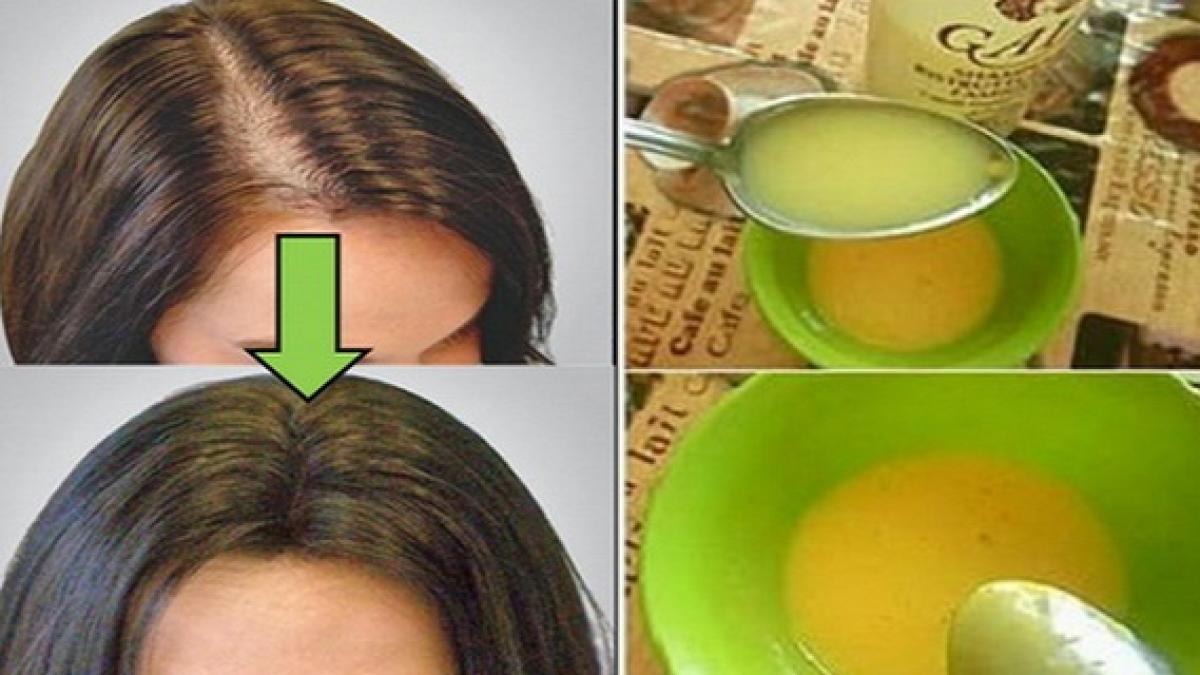 toti medicii au fost surprinsi femeia asta si a aplicat o masca iar parul a inceput sa i creasca