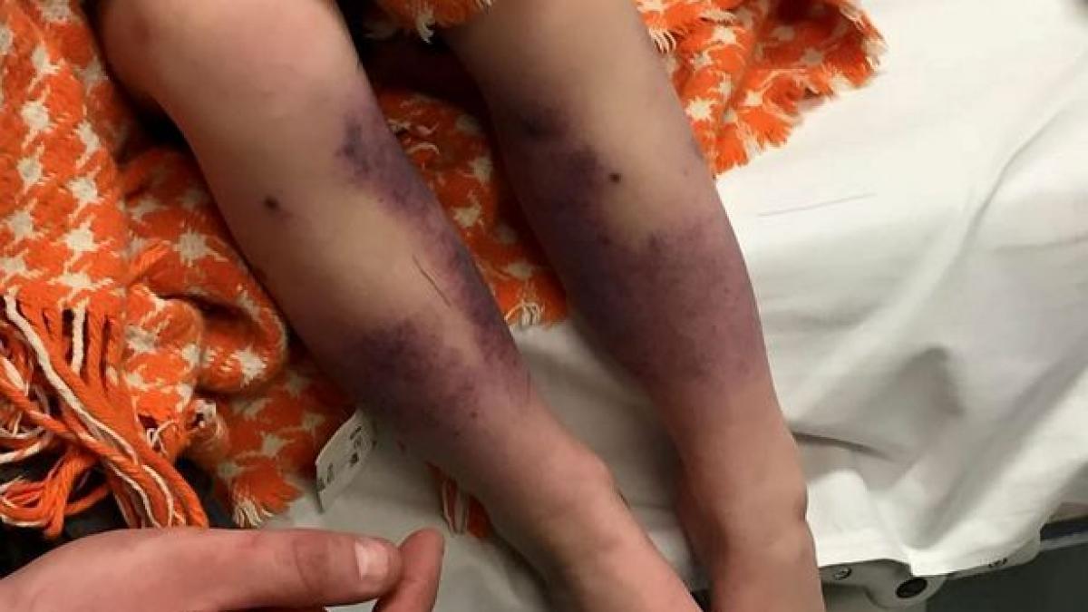 cand aceasta fetita s a trezit picioarele ii erau pline de vanatai motivul este cutremurator