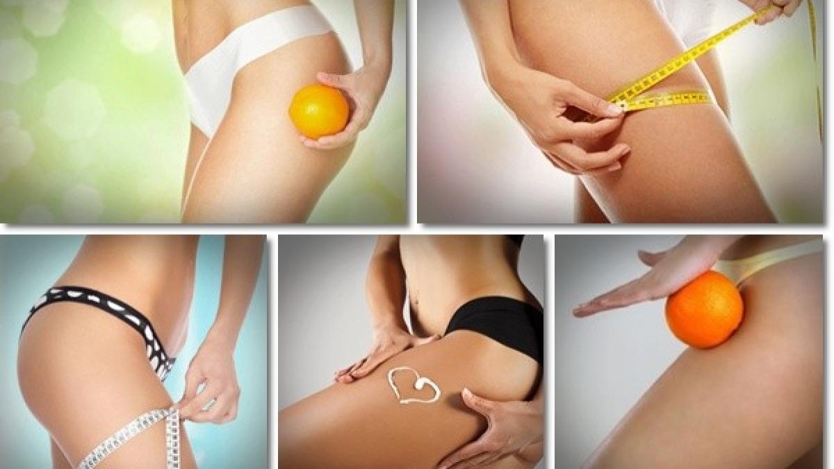 metoda incredibila care topeste celulita scapi de problema pentru totdeauna