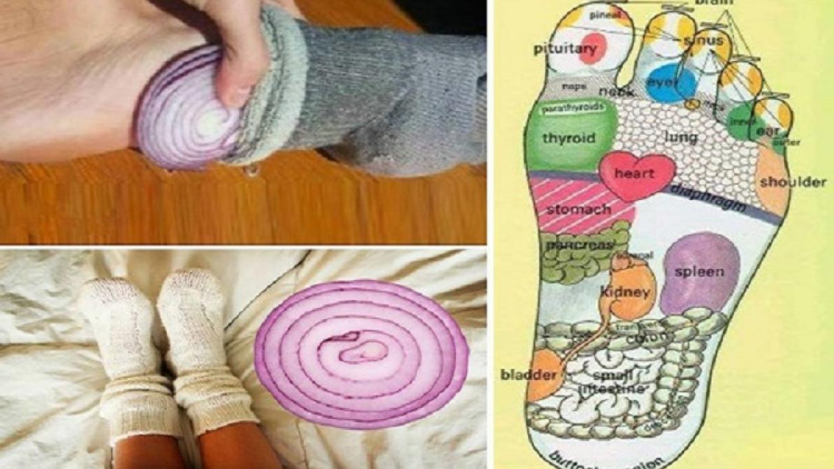 si a pus ceapa in sosete inainte de culcare ce a observat cand s a trezit e uimitor si a pus ceapa in sosete inainte de culcare ce a observat cand s a trezit e uimitor