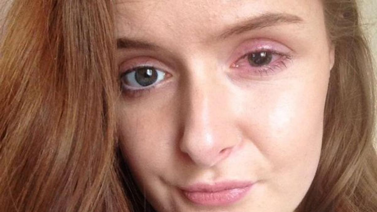 a purtat toata ziua lentile de contact si putea sa isi piarda vederea greseala pe care a facut o