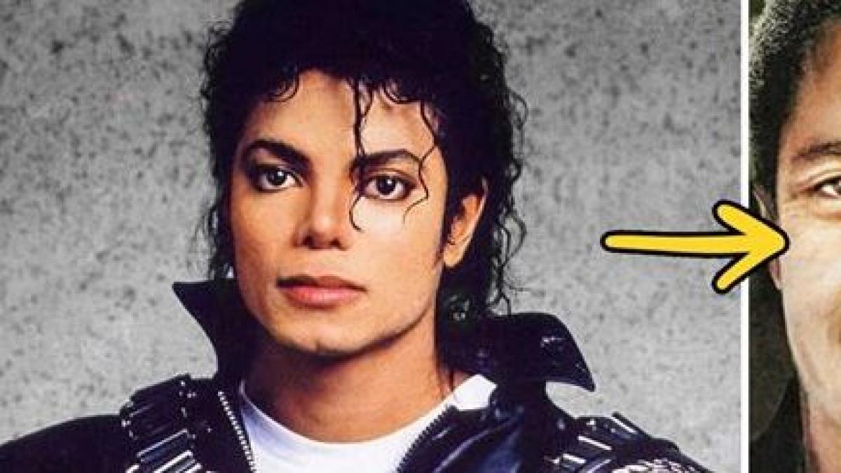 cum ar fi aratat michael jackson daca nu apela la operatiile estetice