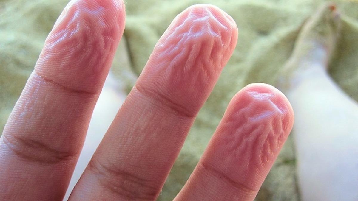 i se increteau mereu degetele si nu stia de ce a mers la doctor si ce a aflat a lasat o cu gura